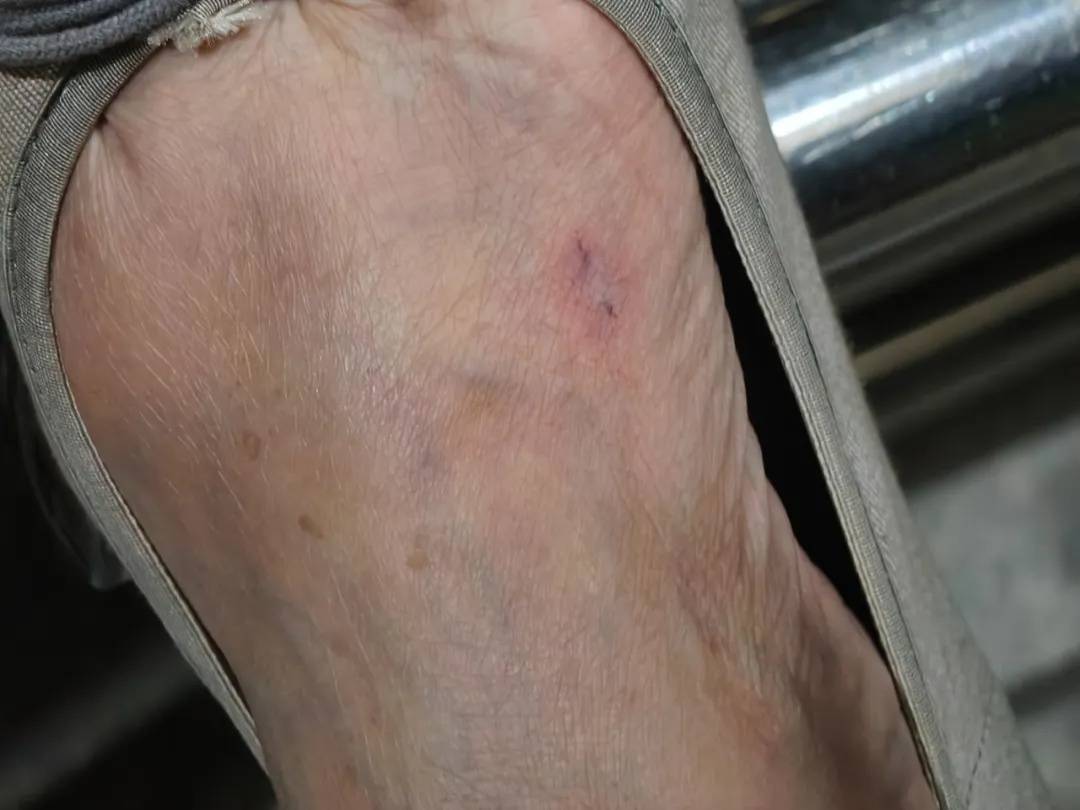 上海七旬老人小区散步被毒蛇咬伤，女儿崩溃：医院怎么选……这份救命指南快收好！