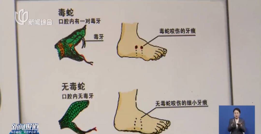 上海七旬老人小区散步被毒蛇咬伤，女儿崩溃：医院怎么选……这份救命指南快收好！